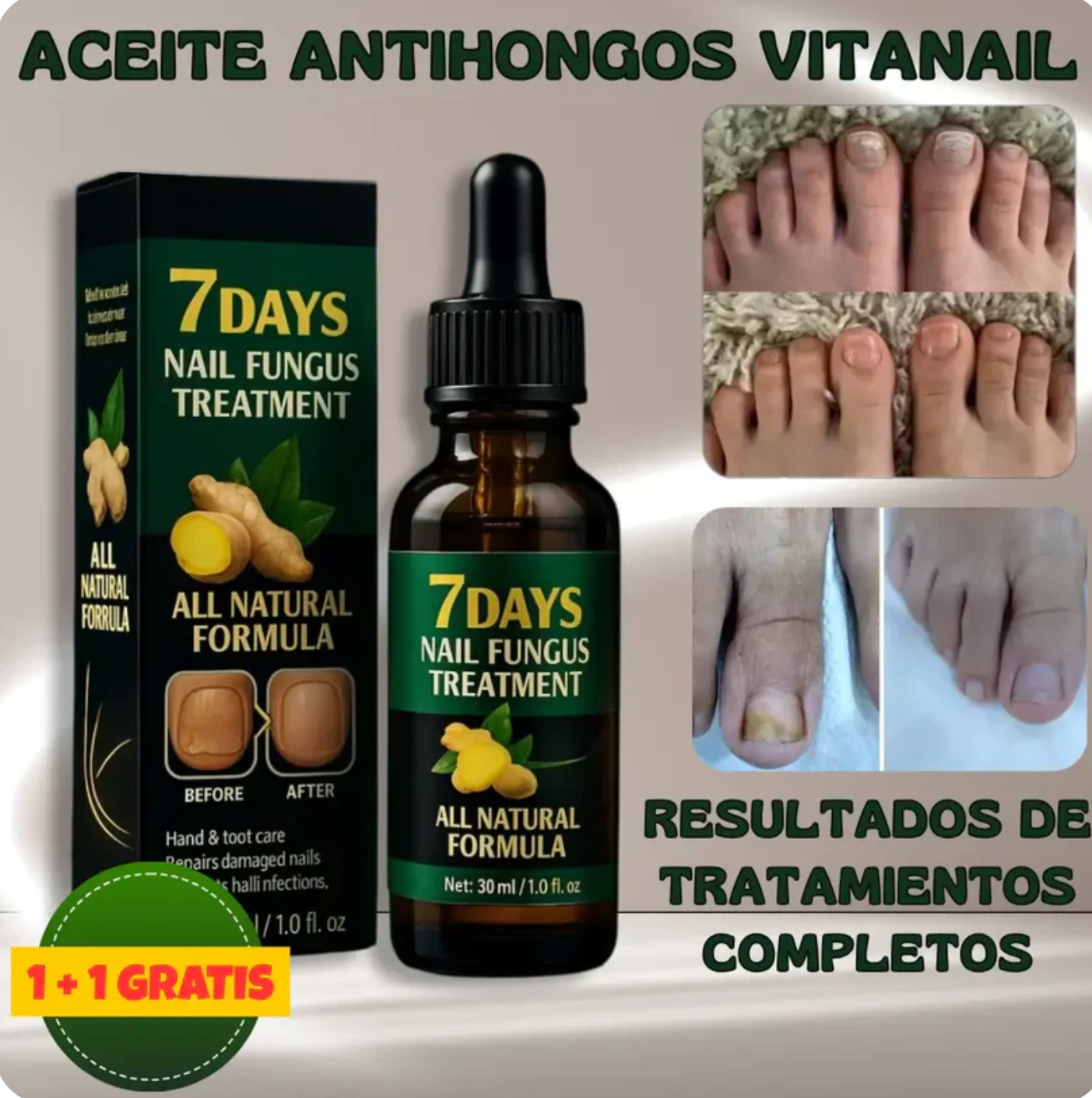 Tratamiento anti hongos 100% NATURAL 7 dias (2x1)