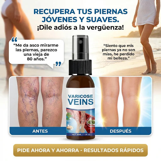 El Spray que Usan Camareras y Enfermeras para Aguantar 8 Horas de Pie sin Piernas Destrozadas