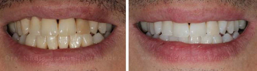 Antonio G.| 35 años