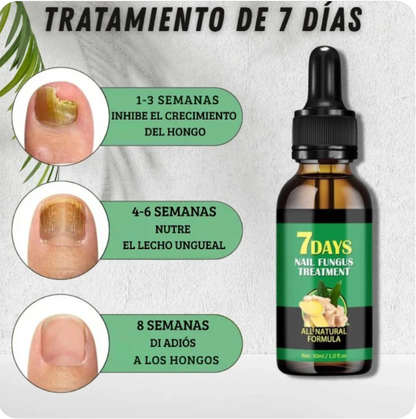 ¡Di adiós a los hongos en las uñas en solo 7 días con 100% ingredientes naturales!"