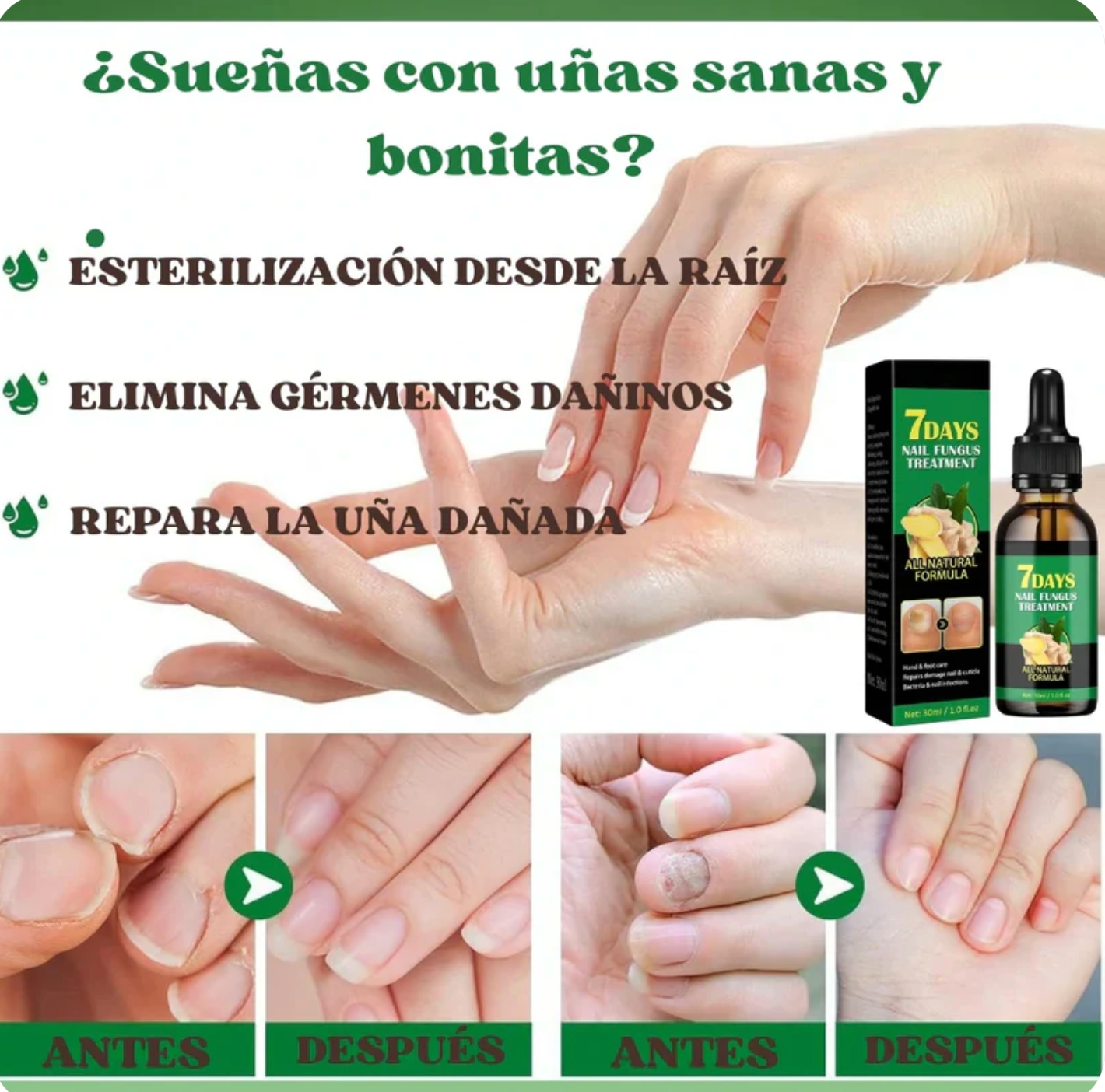 ¡Di adiós a los hongos en las uñas en solo 7 días con 100% ingredientes naturales!"