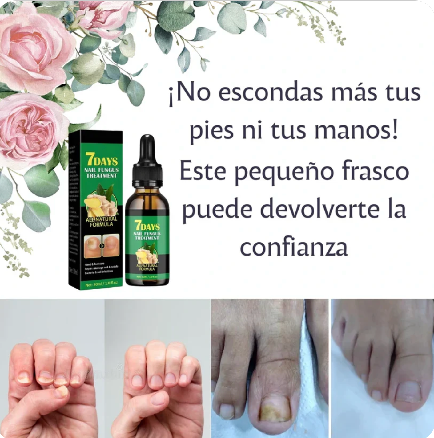 ¡Di adiós a los hongos en las uñas en solo 7 días con 100% ingredientes naturales!"