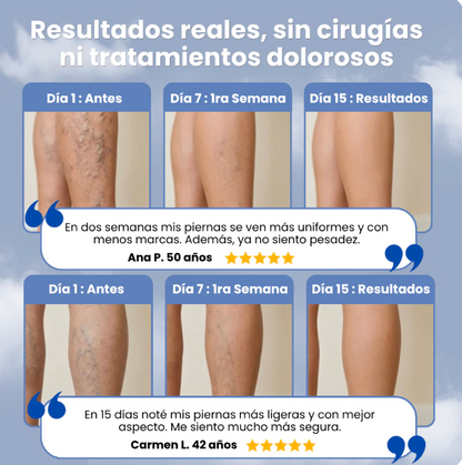 El Spray que Usan Camareras y Enfermeras para Aguantar 8 Horas de Pie sin Piernas Destrozadas