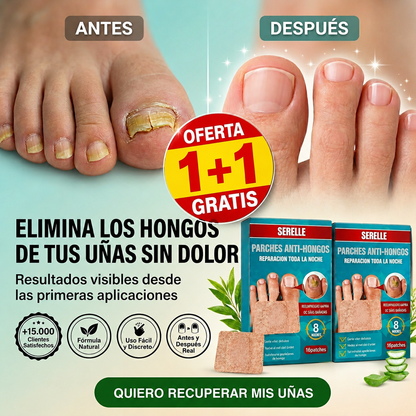 ELIMINA Los Hongos Que Te Dan VERGÜENZA En Solo 7 Días