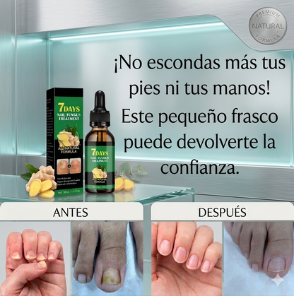 Tratamiento anti hongos 100% NATURAL 7 dias (2x1)