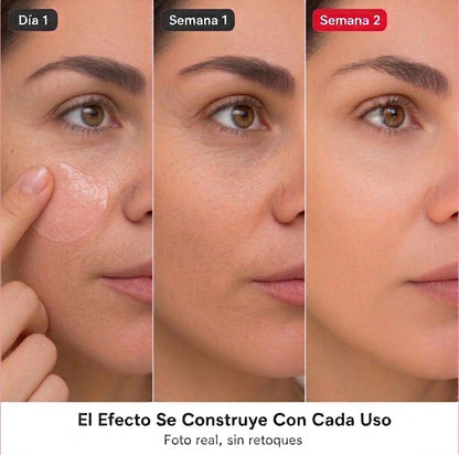 Crema PDRN - Frena las Líneas Antes de que Se Queden, sin Agujas