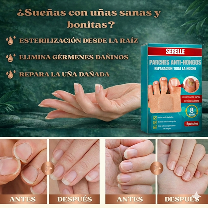 ELIMINA Los Hongos Que Te Dan VERGÜENZA En Solo 7 Días