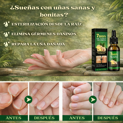 ¡Despidete de los hongos en las uñas en solo 7 días con 100% ingredientes naturales!