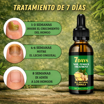¡Despidete de los hongos en las uñas en solo 7 días con 100% ingredientes naturales!