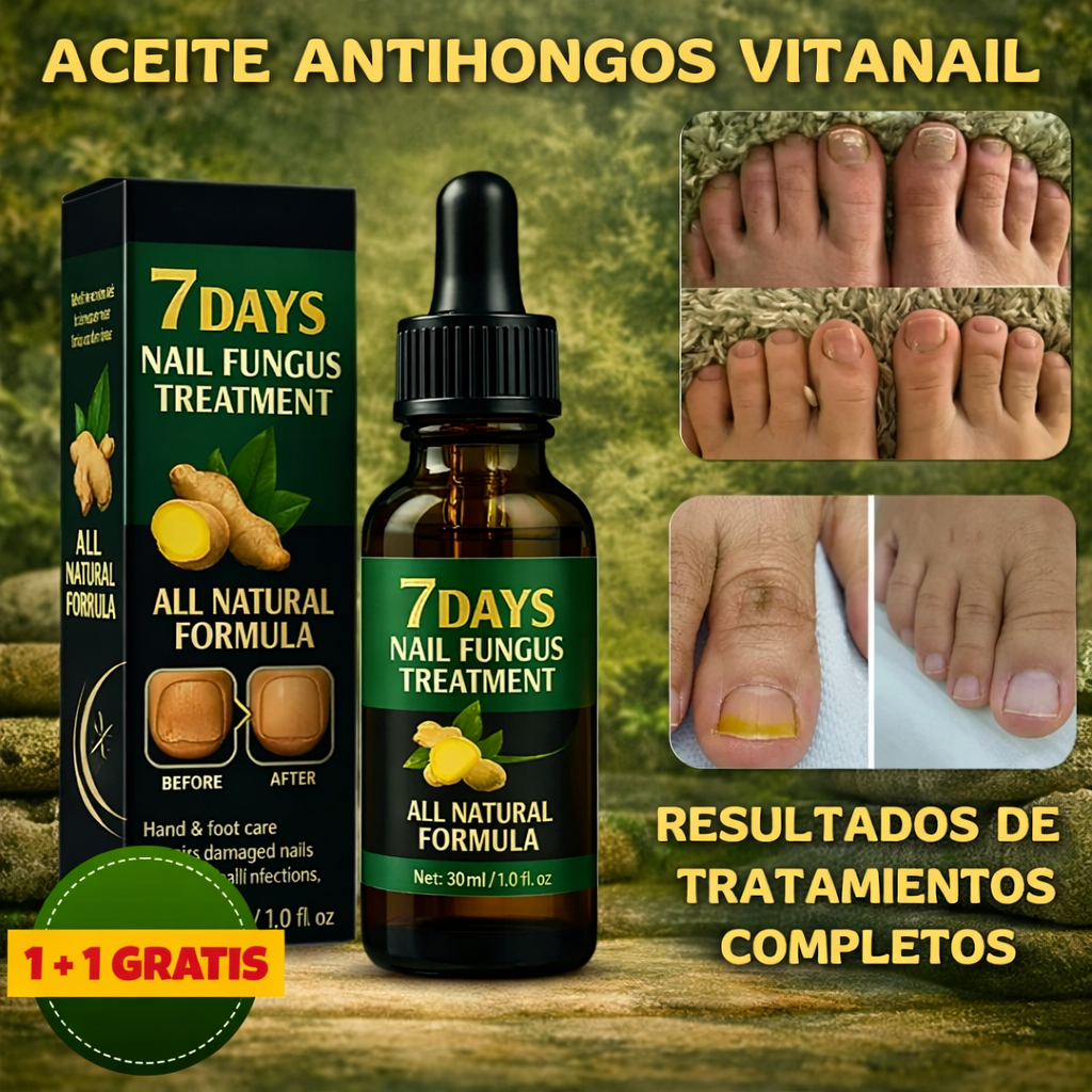 ¡Despidete de los hongos en las uñas en solo 7 días con 100% ingredientes naturales!