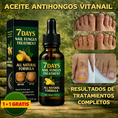 ¡Despidete de los hongos en las uñas en solo 7 días con 100% ingredientes naturales!